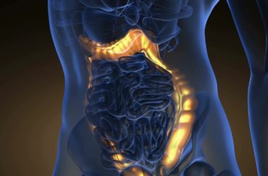 Tumore del colon: microbiota responsabile delle metastasi al fegato