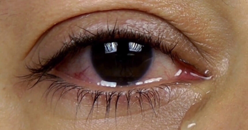 Cornea, in Italia 2 mila infezioni da funghi ogni anno