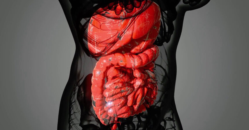 Calcoli della colecisti, una patologia comune ma spesso asintomatica